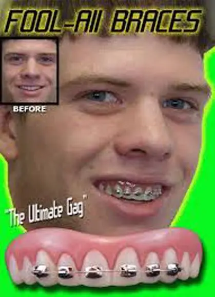 Billy Bob Fake Teeth With Braces 1
